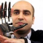 El doctor Kianoush Nazarpour, con la mano biónica