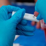 Mayor fracaso virológico con un sólo farmaco para el VIH