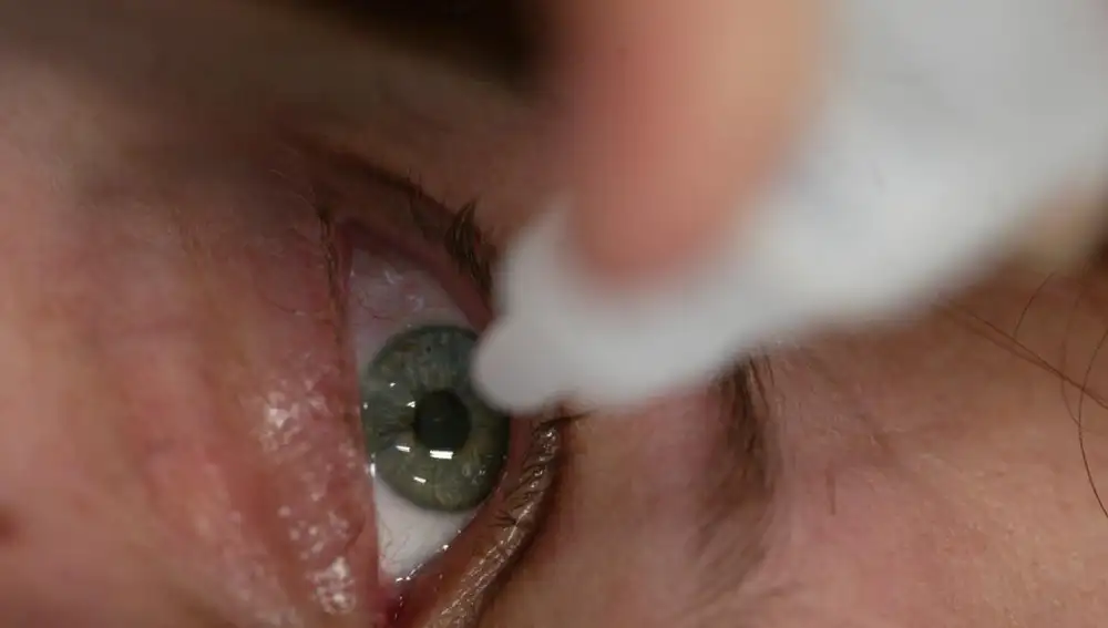 El «ojo seco» es una dolencia cada vez más habitual por la sobreexposición a las pantallas de ordenador