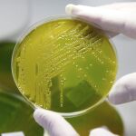 Una muestra de la bacteria E.coli que provocó decenas de muertos en Europa en 2011