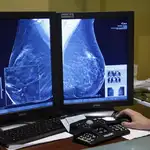 Imagen de una mamografía