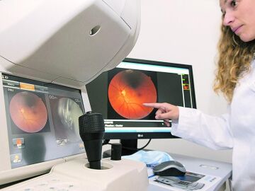 La retinopat&iacute;a diab&eacute;tica afecta a 1 de cada 4 personas con diabetes