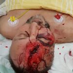 Frank Magnitz tiene graves heridas en la cabeza/Reuters