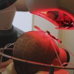 Uno de los sistemas robóticos usados para el transplante de pelo