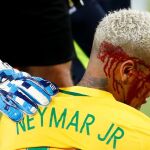 Neymar, ensangrentado tras recibir un codazo