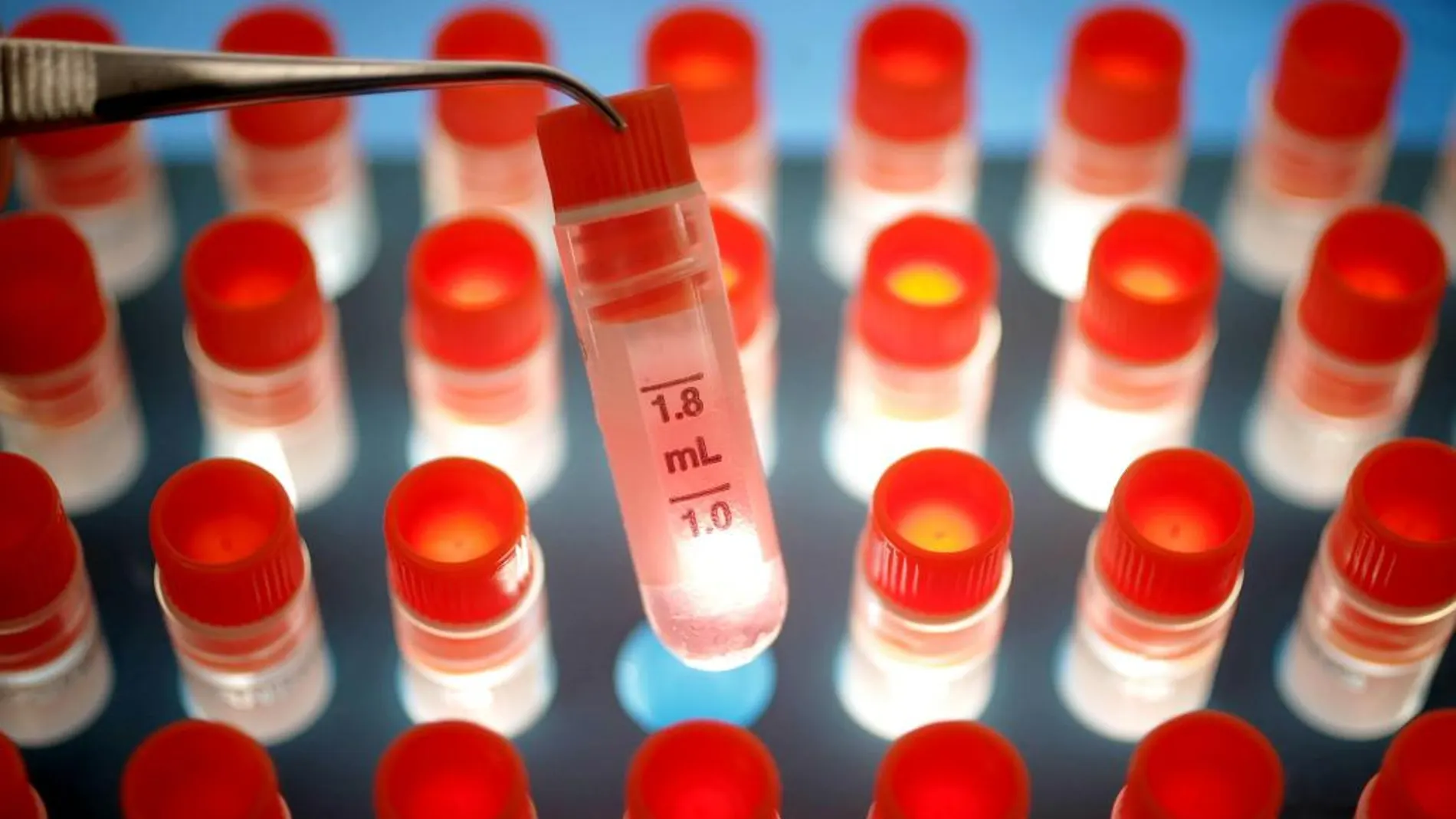 Descubren un interruptor molecular clave para el tratamiento del cáncer o el alzhéimer