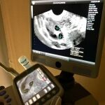 Ecógrafo digital Ultrasonix Touch Q+, único en España