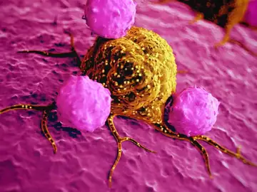 Células cancerosas / Dreamstime Células cancerosas / Dreamstime