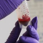 Sangre artificial, solución nipona para el suministro global de transfusiones