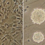 Investigadores del CONICET lograron un importante avance sobre los mecanismos de origen y crecimiento del glioblastoma, una variante de c&aacute;ncer muy agresiva