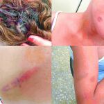 Fotografías facilitadas por el Observatorio contra la LGBTfobia, de las agresiones sufridas por una transexual en un polígono de la capital malagueña.