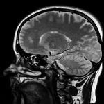 Un escáner del cerebro, en una de las pruebas realizadas para el estudio de los investigadores del Human Pain Research Group de la Universidad de Manchester