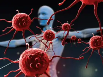 Las enfermedades autoinmunes incrementan el riesgo cardiovascular y de mortalidad Las enfermedades autoinmunes incrementan el riesgo cardiovascular y de mortalidad