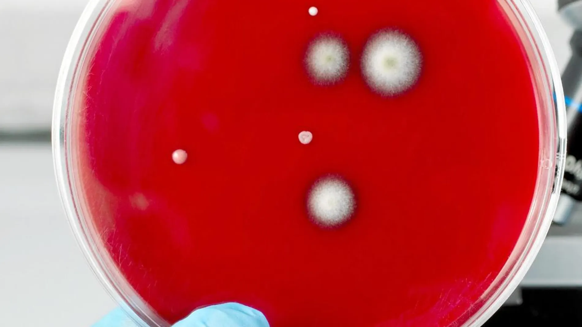 La lucha contra las infecciones por superbacterias va con retraso