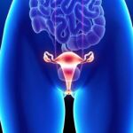 Imagen de un escáner de un caso de cáncer de ovarios