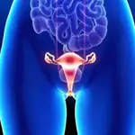 Imagen de un escáner de un caso de cáncer de ovarios