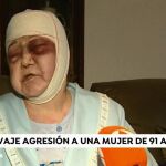 La anciana sufrió diversos cortes y contusiones