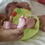 Incluir la atrofia muscular en la conocida como prueba del talón puede ayudar a su tratamiento