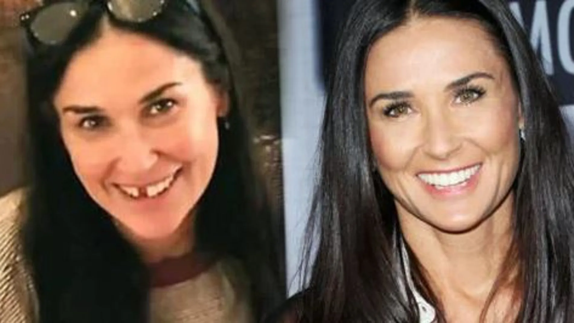 La actriz perdió piezas por el estrés