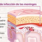 Nuevo «escudo» frente a la meningitis B para niños y adolescentes