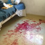Manchas de sangre derivadas del corte en el brazo que se hizo a sí mismo el recluso