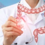 Detectar a tiempo el cáncer de recto, vital para su curación: 8 signos de los que sospechar