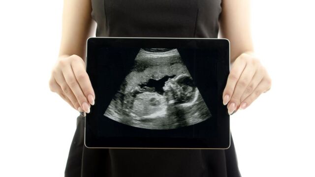 El negocio del aborto: 40 millones menos para las clínicas
