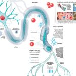 Esclerosis múltiple: llega una pastilla diaria con menos secuelas