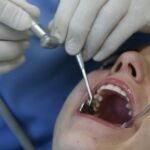 Odontofobia: el miedo al dentista y la crisis «pican» los dientes