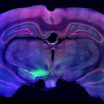 El trasplante de neuronas dopaminérgicas podría revertir el daño que el párkinson hace en estas células