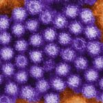 Imagen miocroscópica del norovirus