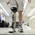 Los accidentes de tráfico son las principales causas de amputaciones por delante de la diabetes