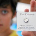 Los pies de un feto de 10 semanas, símbolo internacional provida