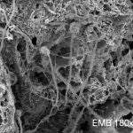 Bacterias mesófilas