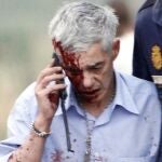 En la imagen, el maqunista, Francisco José Garzón, herido tras el accidente, habla por el móvil