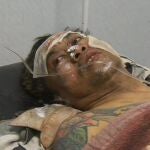Algunos de los rescaatados tienen heridas graves