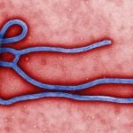 Virus del ébola