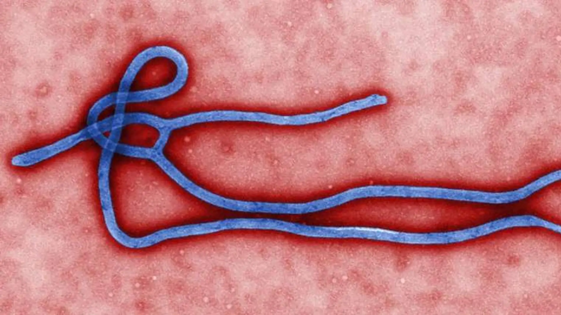 Virus del ébola