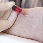 ¿Salud en vena? Los expertos alertan de riesgos en órganos internos