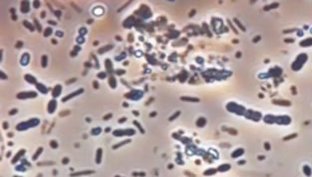 Fotografía de muestra de microbiota de heces humanas.