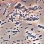 Fotografía de muestra de microbiota de heces humanas.