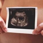 Cuanto más prematuros son los recién nacidos, más complicaciones presentan debido a su inmadurez.