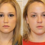 Shelley Dufresne (izquierda), de 32 años, y Rachel Respess, de 24.
