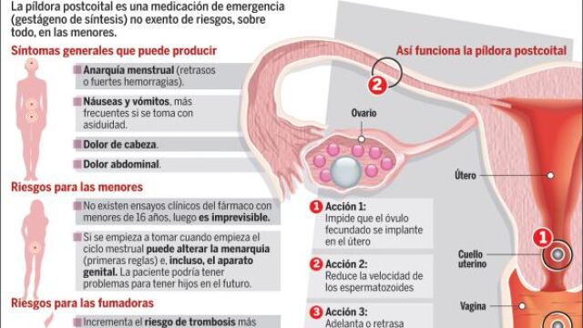 Las secuelas de la píldora del día después, impredecibles en niñas