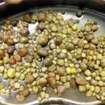 Extirpan 420 piedras del riñón de un paciente