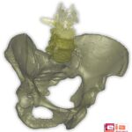 Reconstrucción de la pelvis hallada en Atapuerca