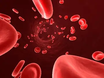 La anemia es un trastorno que consiste en una disminución en el número de glóbulos rojos y/o hemoglobina en sangre | Ilustración de archivo La anemia es un trastorno que consiste en una disminución en el número de glóbulos rojos y/o hemoglobina en sangre | Ilustración de archivo