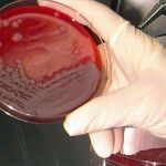 Muestras de ántrax en un laboratorio