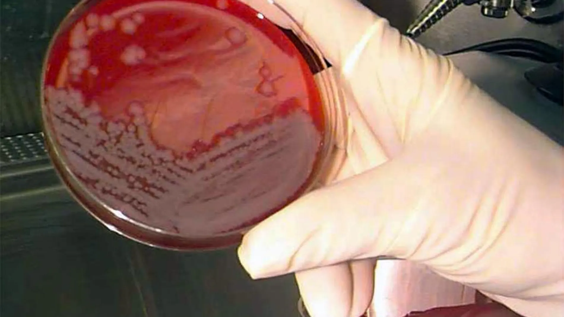 Muestras de ántrax en un laboratorio