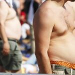 La obesidad mata
